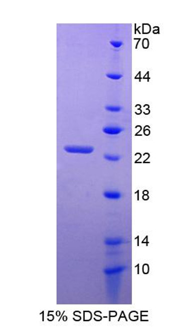 Human Recombinant Aryl Hydrocarbon Receptor Nuclear Translocator (ARNT)