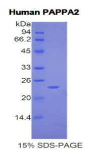 Human Recombinant Pappalysin 2 (PAPPA2)