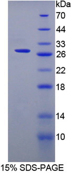 Rat Recombinant Surfactant Associated Protein A2 (SPA2)