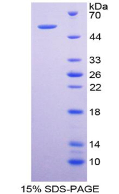 Human Recombinant Cytochrome P450 26B1 (CYP26B1)