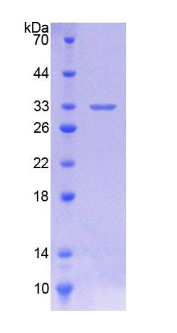 Pig Recombinant Cytochrome P450 11A1 (CYP11A1)
