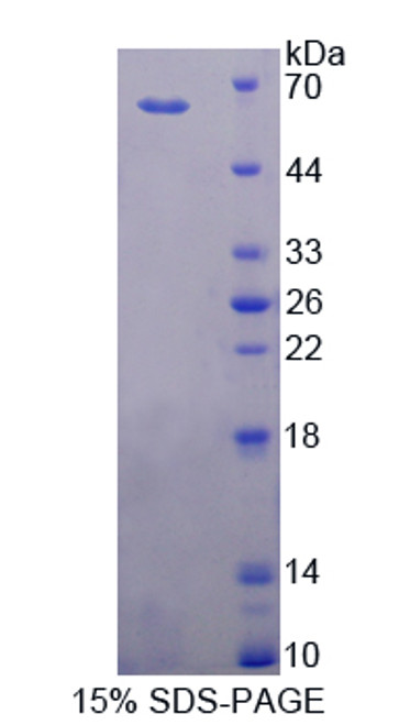 Rat Recombinant Cytochrome P450 11B1 (CYP11B1)