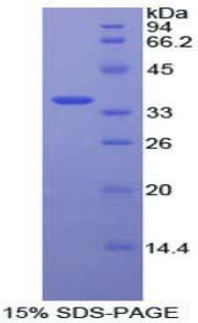 Human Recombinant Mitogen Activated Protein Kinase Kinase 7 (MAP2K7)