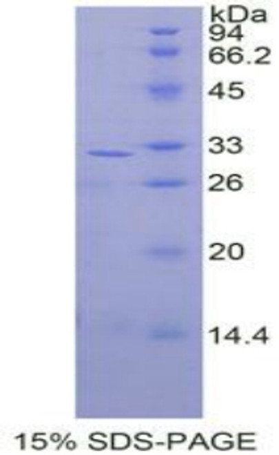 Human Recombinant Mitogen Activated Protein Kinase Kinase 3 (MAP2K3)