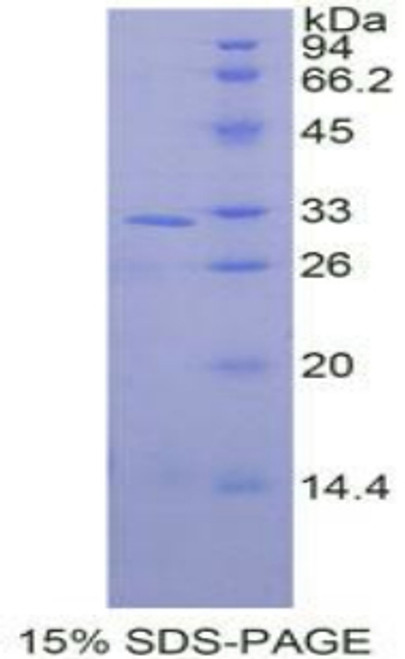 Human Recombinant Mitogen Activated Protein Kinase 9 (MAPK9)