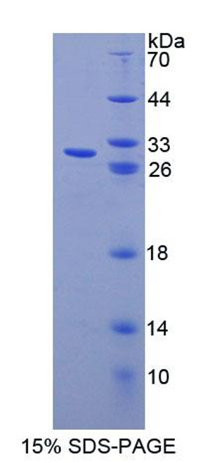 Mouse Recombinant ATP Binding Cassette Transporter F1 (ABCF1)