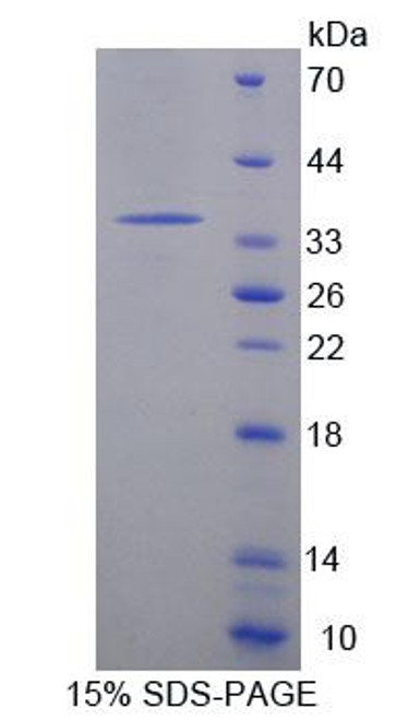 Mouse Recombinant Acyl Coenzyme A Dehydrogenase, C4-To-C12 Straight Chain (ACADM)