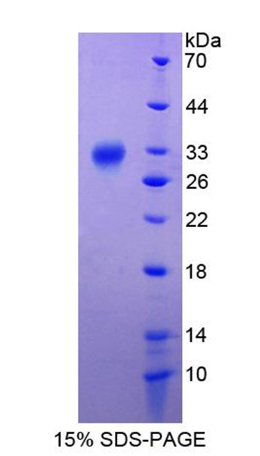 Cattle Recombinant Apolipoprotein A1 Binding Protein (APOA1BP)