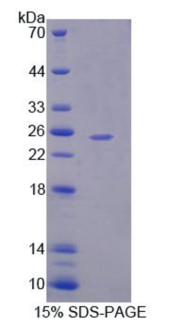 Human Recombinant Pyruvate Dehydrogenase Phosphatase 2 (PDP2)