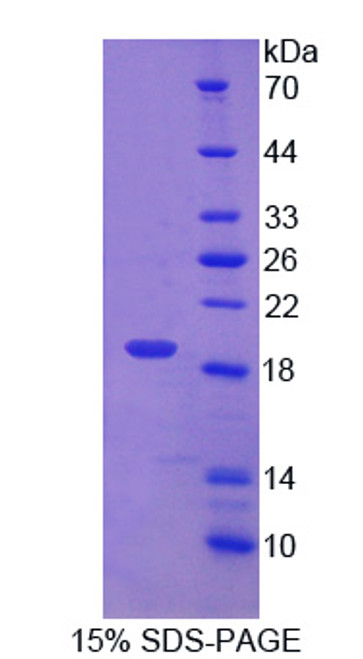 Human Recombinant Protein Disulfide Isomerase A5 (PDIA5)