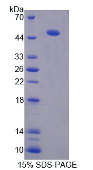 Human Recombinant Protein Disulfide Isomerase A6 (PDIA6)