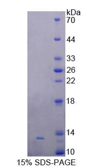 Rat Recombinant Galanin Like Peptide (GALP)