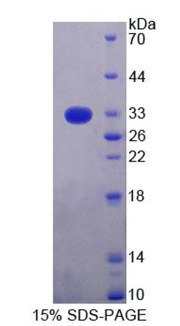 Rat Recombinant Topoisomerase I, Mitochondrial (TOP1MT)