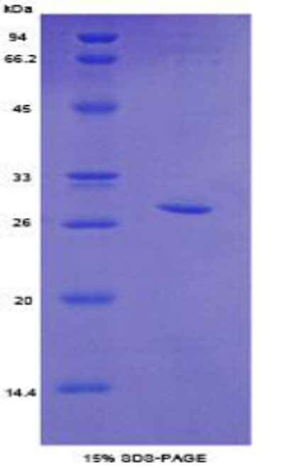 Mouse Recombinant Topoisomerase II Beta (TOP2b)