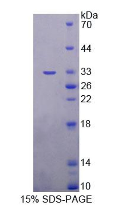 Human Recombinant Alanine Glyoxylate Aminotransferase 2 (AGXT2)