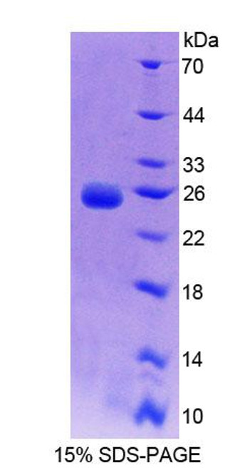 Rat Recombinant Branched Chain Aminotransferase 2, Mitochondrial (BCAT2)