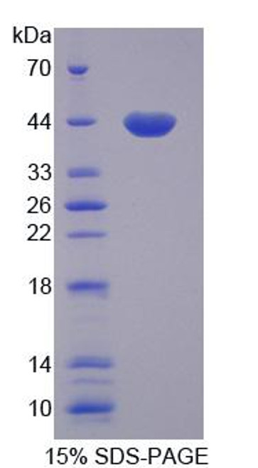 Rat Recombinant General Transcription Factor IIIA (GTF3A)