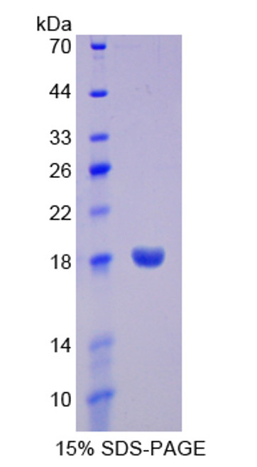 Human Recombinant Tumor Necrosis Factor Receptor Superfamily, Member 19 (TNFRSF19)