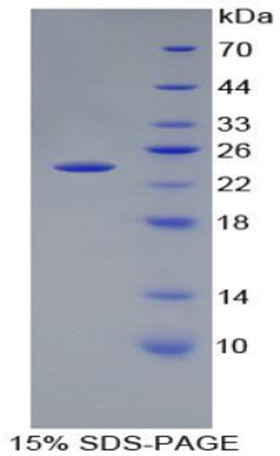 Human Recombinant Peptidoglycan Recognition Protein 1 (PGLYRP1)