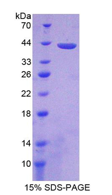 Rat Recombinant Protein Phosphatase 2A Activator, Regulatory Subunit 4 (PPP2R4)