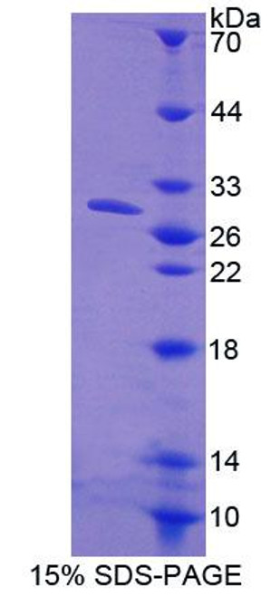 Human Recombinant Calcineurin Like Phosphoesterase Domain Containing Protein 1 (CPPED1)