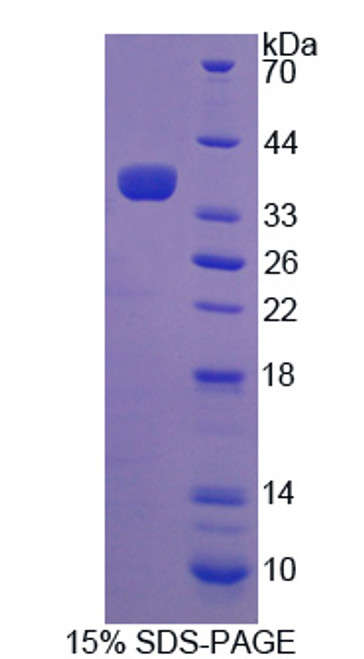 Human Recombinant Protocadherin Gamma A2 (PCDHgA2)