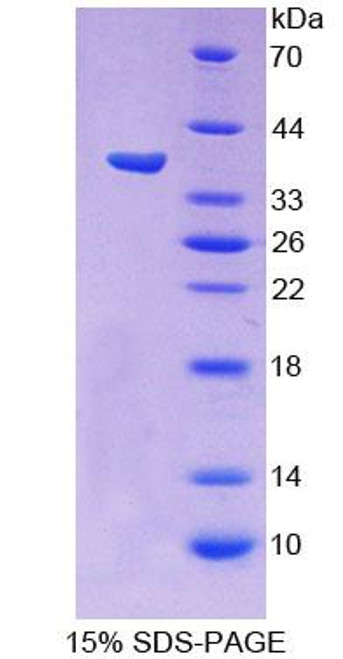 Human Recombinant Protocadherin Beta 15 (PCDHb15)