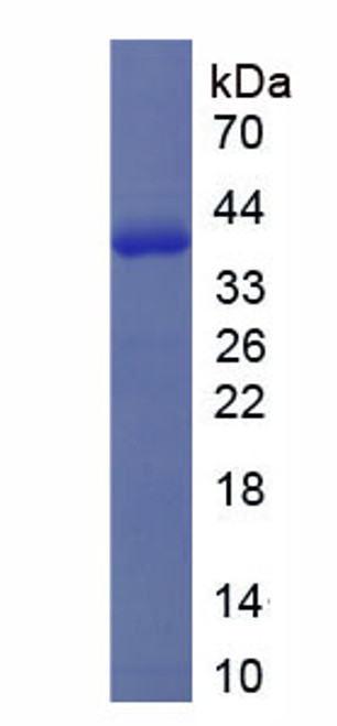 Human Recombinant Defensin Alpha 4, Corticostatin (DEFa4)