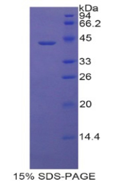 Rat Recombinant Lipocalin 6 (LCN6)