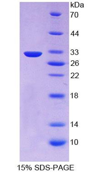 Human Recombinant Proprotein Convertase Subtilisin/Kexin Type 1 (PCSK1)