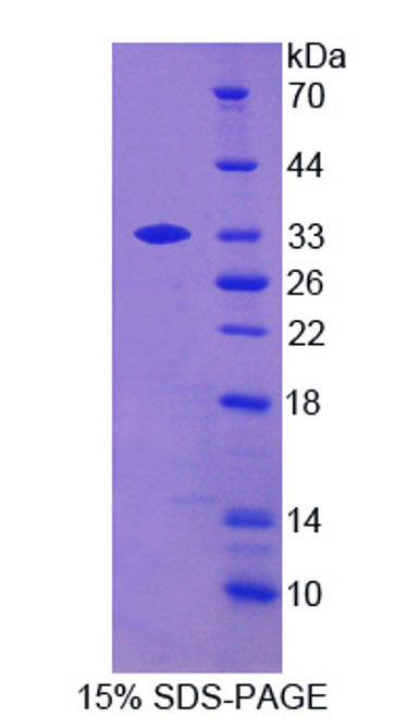 Human Recombinant B-Lymphoid Tyrosine Kinase (BLK)