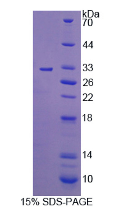 Human Recombinant C-Mer Proto Oncogene Tyrosine Kinase (MERTK)