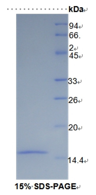 Human Recombinant Solute Carrier Family 30 Member 8 (SLC30A8)