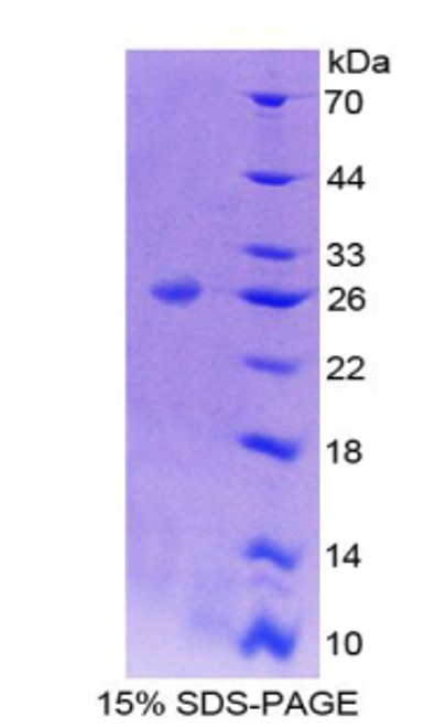 Mouse Recombinant B-Cell CLL/Lymphoma 9 (Bcl9)