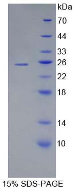 Human Recombinant Ubiquitin Conjugating Enzyme E2C (UBE2C)