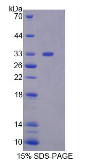 Mouse Recombinant Guanylate Binding Protein 2, Interferon Inducible (GBP2)