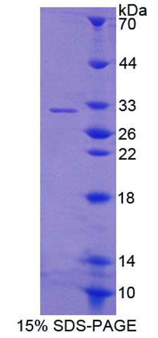 Rat Recombinant Guanylate Binding Protein 2, Interferon Inducible (GBP2)