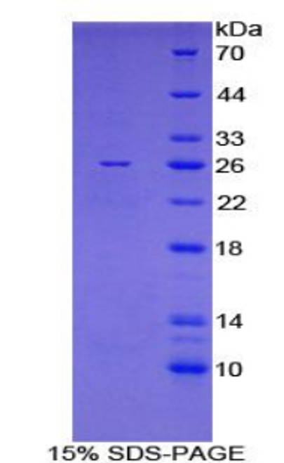 Mouse Recombinant FK506 Binding Protein 8 (FKBP8)
