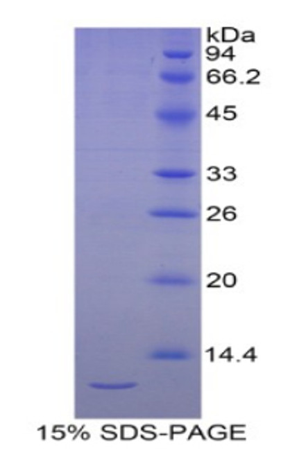 Human Recombinant Selenoprotein W1 (SEPW1)