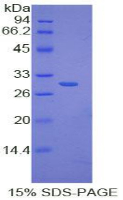 Human Recombinant Inhibitory Subunit Of NF Kappa B Delta (IkBd)