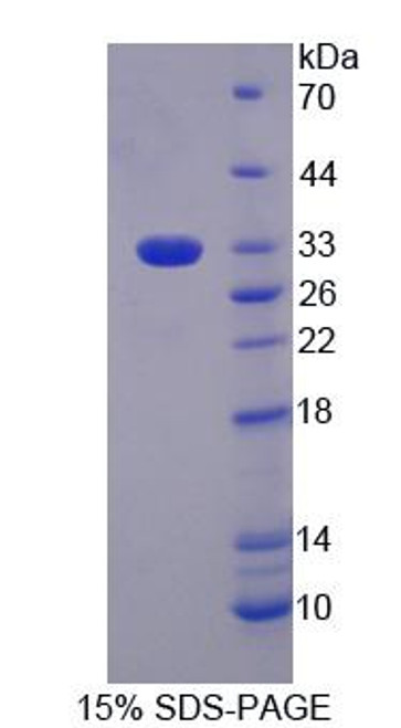 Mouse Recombinant Phosphoglucomutase 3 (PGM3)