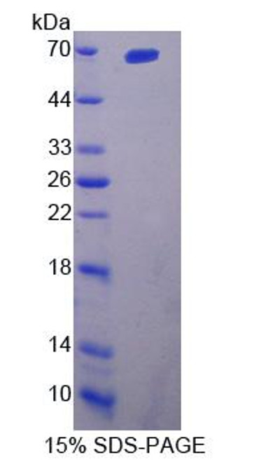 Rat Recombinant Interleukin 23 Receptor (IL23R)
