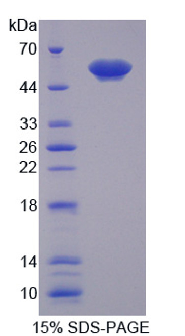 Human Recombinant Annexin A11 (ANXA11)