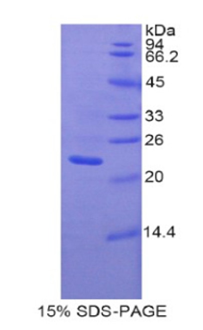 Rat Recombinant Pannexin 1 (PANX1)