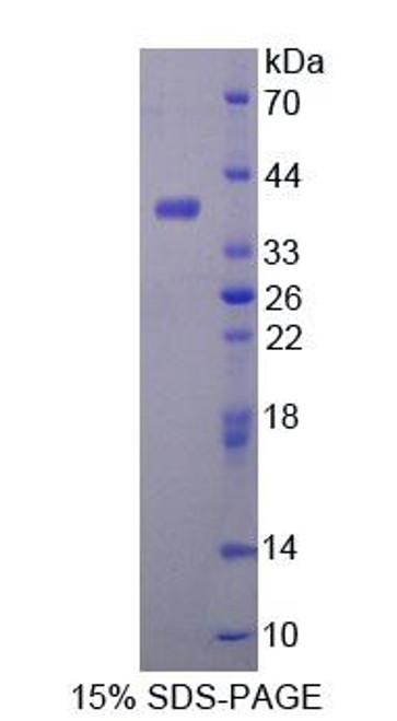 Mouse Recombinant Aldehyde Dehydrogenase 1 Family, Member A1 (ALDH1A1)