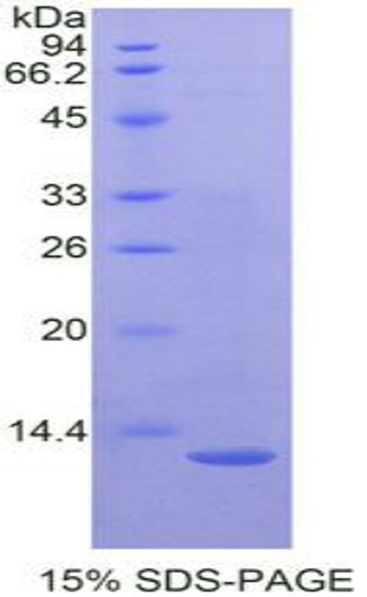 Mouse Recombinant Catenin Beta Interacting Protein 1 (CTNNbIP1)