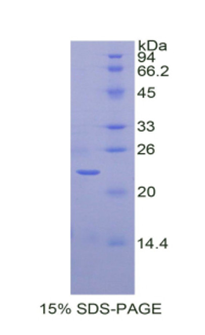 Rat Recombinant Sirtuin 3 (SIRT3)