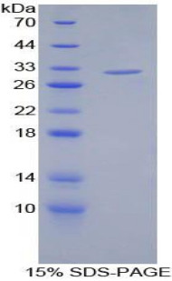 Human Recombinant Filamin C Gamma (FLNC)