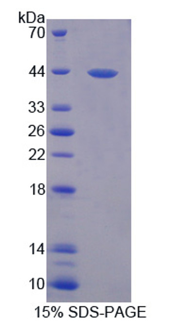 Human Recombinant Ring Finger Protein 55 (RNF55)