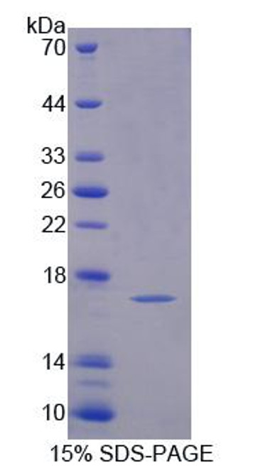 Mouse Recombinant Profilin 4 (PFN4)